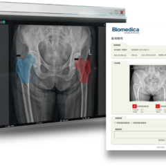 【OpenVINO開發案例】骨質疏鬆人工智慧輔助篩檢系統