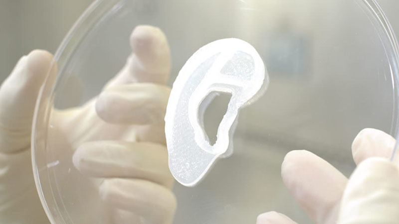 日前，美國醫療團隊成功將由生物技術公司3DBio Therapeutics所研發的人體細胞3D列印耳朵，移植到一名患者身上，此一技術或許將造福無數小耳症患者，幫助他們擁有正常的外觀。