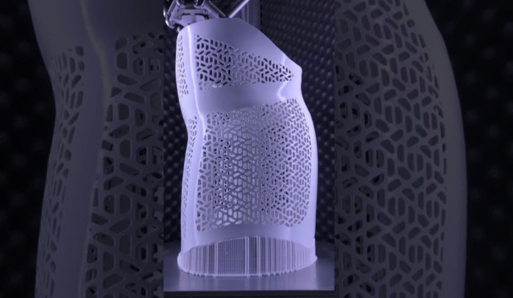 由義大利生物醫學初創公司Exos所研發的的Armor系列可客製後背背架，以獨家3D列印技術打造出更符合個人需求的矯正產品，讓患者佩戴時體感更加舒適。
